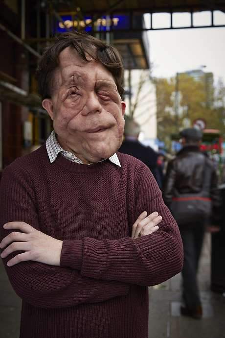 The Ugly Face of Disability Hate Crime (2015) movie poster