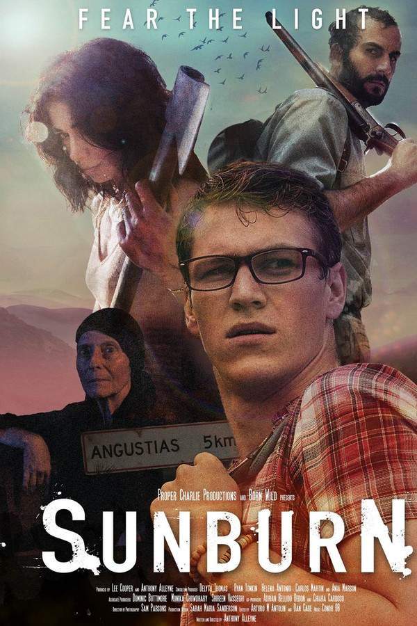 Sunburn